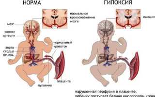 Как курение конопли во время беременности влияет на будущего ребенка