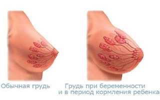 Когда у девушки начинает болеть грудь при беременности